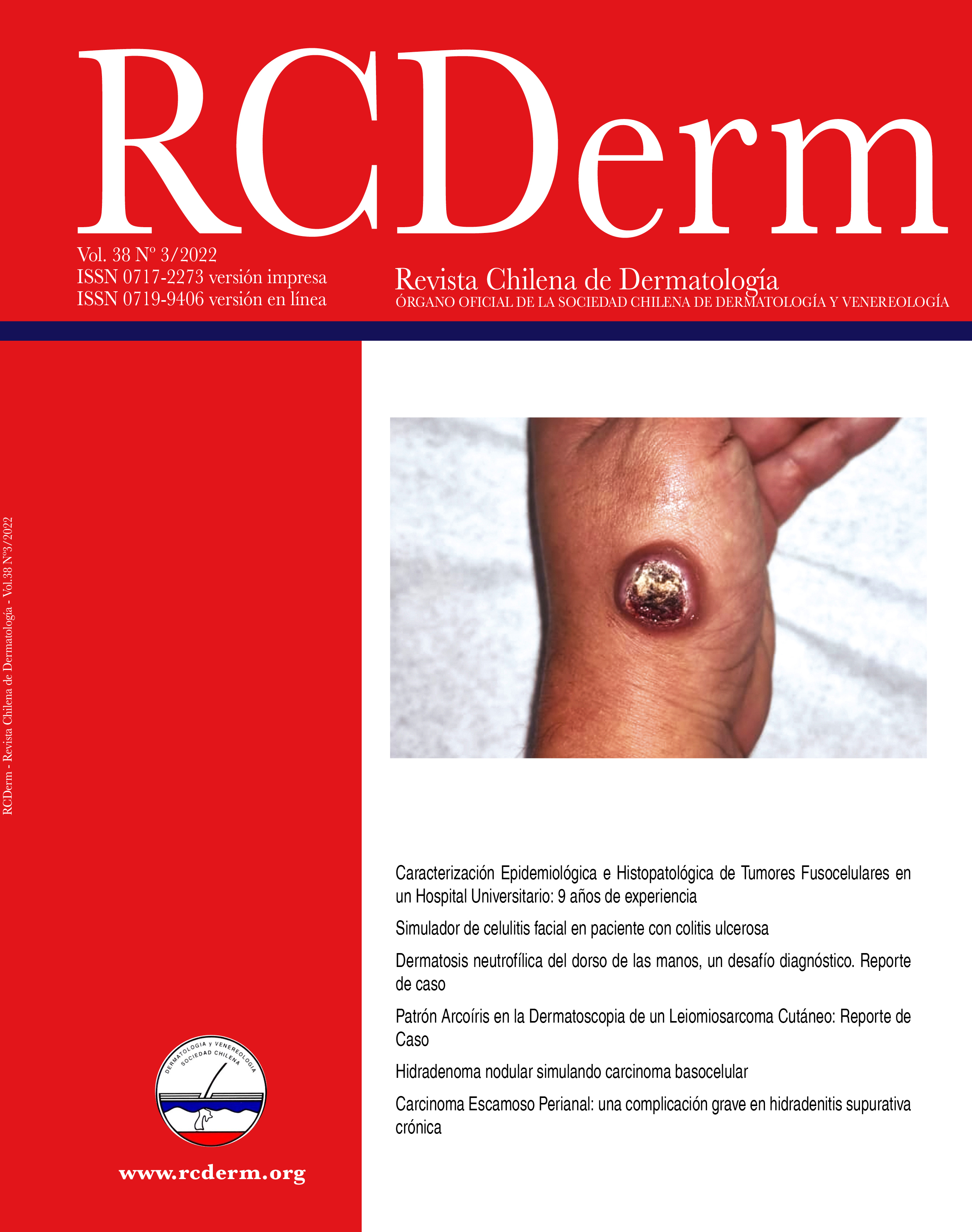 Portada